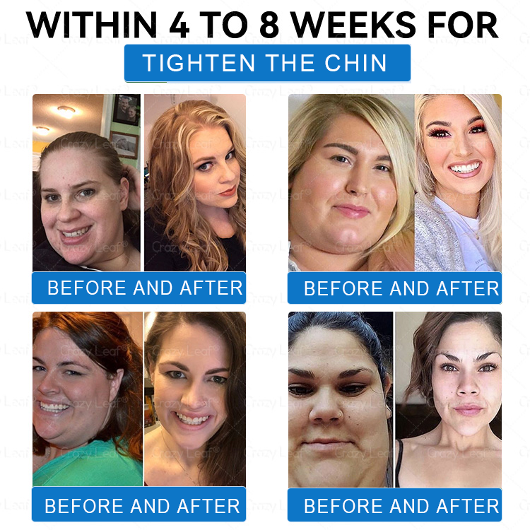 CrazyLeaf®Only 5 boxes left! We're offering you an additional 30% discount! Get yourself in shape and healthy. Miss out now, and you won't have another chance until next year.