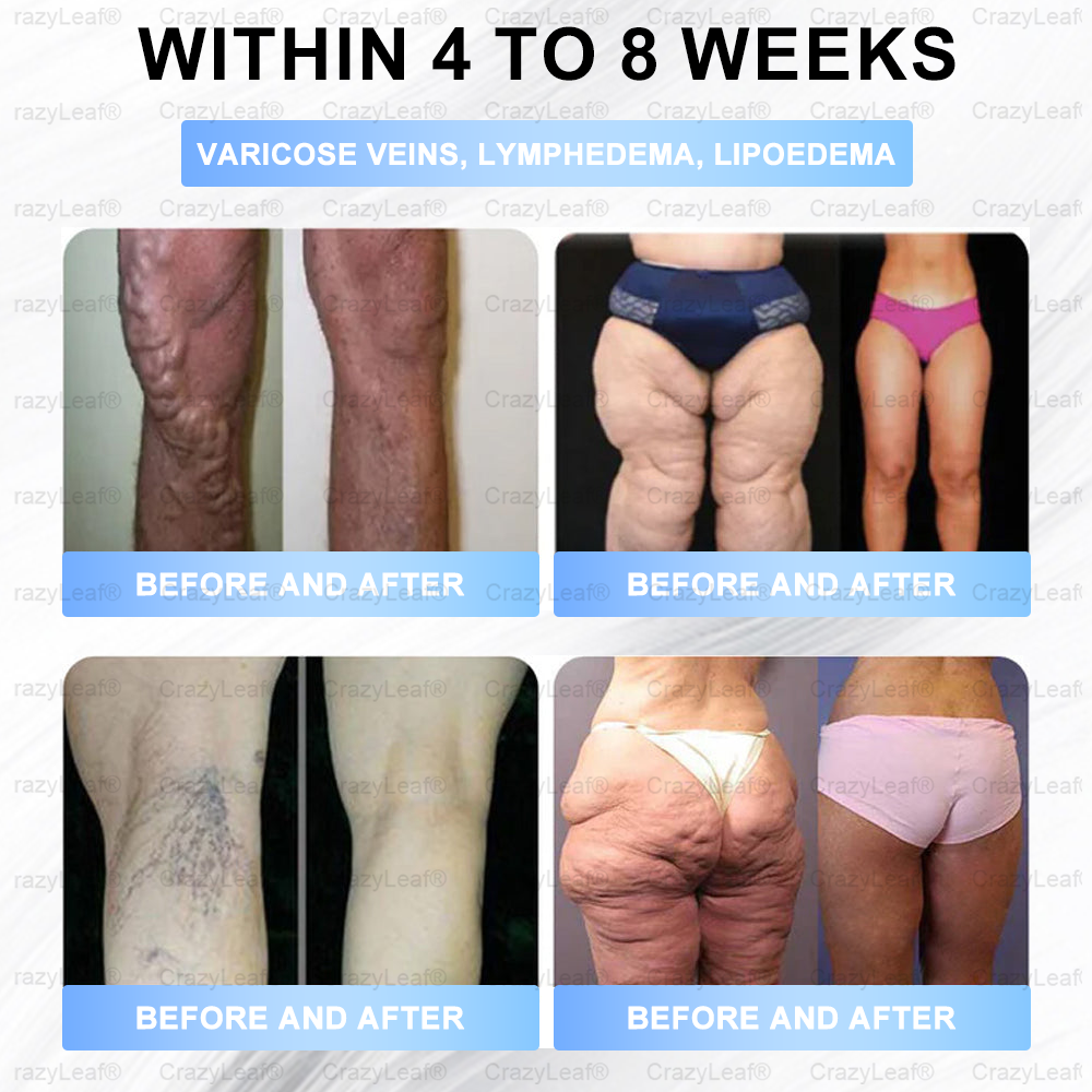 𝐁𝐮𝐢𝐥𝐝𝐋𝐞𝐚𝐟®Only 5 boxes left! We're offering you an additional 30% discount! Get yourself in shape and healthy. Miss out now, and you won't have another chance until next year.