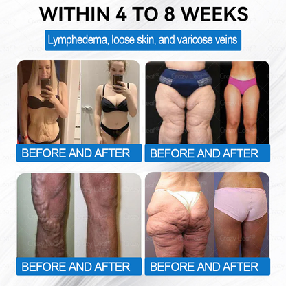 CrazyLeaf®Only 5 boxes left! We're offering you an additional 30% discount! Get yourself in shape and healthy. Miss out now, and you won't have another chance until next year.