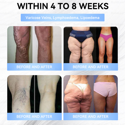 🇨🇦𝐁𝐮𝐢𝐥𝐝𝐋𝐞𝐚𝐟®Only 5 boxes left! We're offering you an additional 30% discount! Get yourself in shape and healthy. Miss out now, and you won't have another chance until next year.