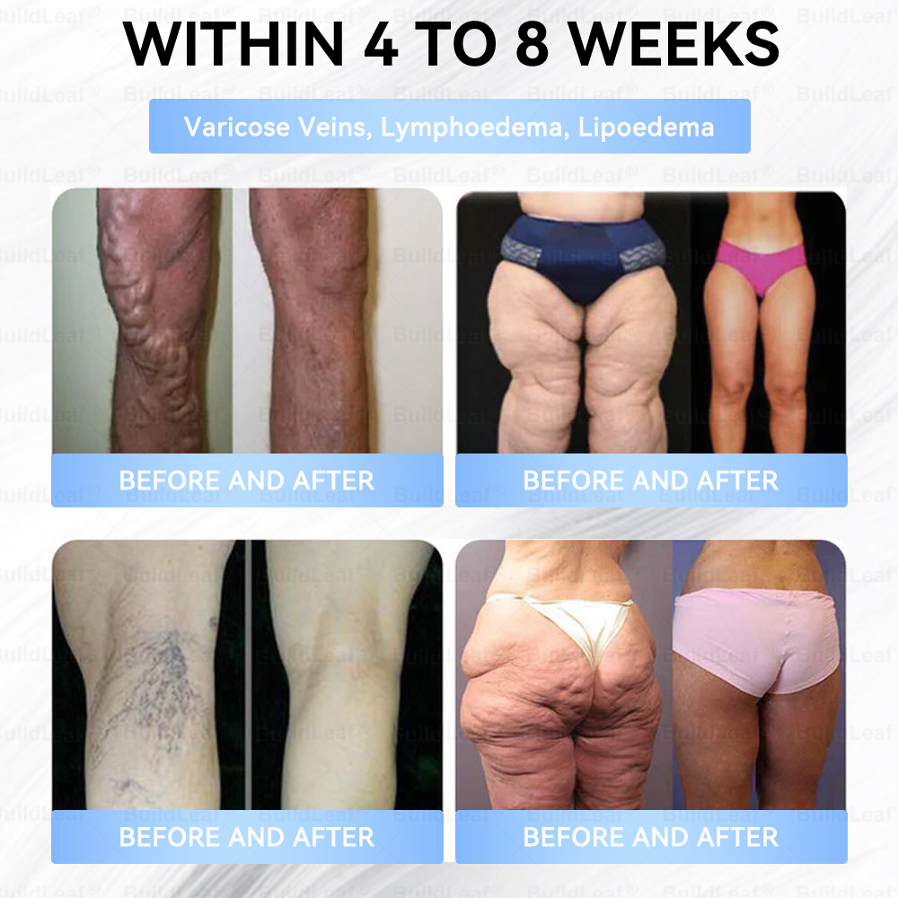 🇨🇦𝐎𝐟𝐟𝐢𝐜𝐢𝐚𝐥 𝐒𝐭𝐨𝐫𝐞·𝐁𝐮𝐢𝐥𝗱𝐋𝐞𝐚𝐟®𝐒𝐥𝐢𝐦 & 𝐅𝐢𝐫𝐦 𝐍𝐚𝐧𝐨 𝐌𝐢𝐜𝐫𝐨𝐧𝐞𝐞𝐝𝐥𝐞 𝐏𝐚𝐭𝐜𝐡 𝐰𝐢𝐭𝐡 𝐌𝐨𝐫𝐢𝐧𝐠𝐚, 𝐎𝐦𝐞𝐠𝐚-𝟑, 𝐂𝐨𝐥𝐥𝐚𝐠𝐞𝐧 𝐏𝐞𝐩𝐭𝐢𝐝𝐞𝐬, 𝐍𝐀𝐃 & 𝐍𝐌𝐍 𝐟𝐨𝐫 𝐎𝐛𝐞𝐬𝐢𝐭𝐲, 𝐂𝐚𝐫𝐝𝐢𝐨𝐯𝐚𝐬𝐜𝐮𝐥𝐚𝐫 𝐃𝐢𝐬𝐞𝐚𝐬𝐞, 𝐃𝐢𝐚𝐛𝐞𝐭𝐞𝐬, 𝐒𝐥𝐞𝐞𝐩 𝐀𝐩𝐧𝐞𝐚, 𝐉𝐨𝐢𝐧𝐭 𝐏𝐫𝐨𝐛𝐥𝐞𝐦𝐬, 𝐒𝐤𝐢𝐧 𝐅𝐢𝐫𝐦𝐢𝐧𝐠, 𝐀𝐧𝐭𝐢-𝐀𝐠𝐢𝐧𝐠, 𝐚𝐧𝐝 𝐌𝐨𝐫𝐞