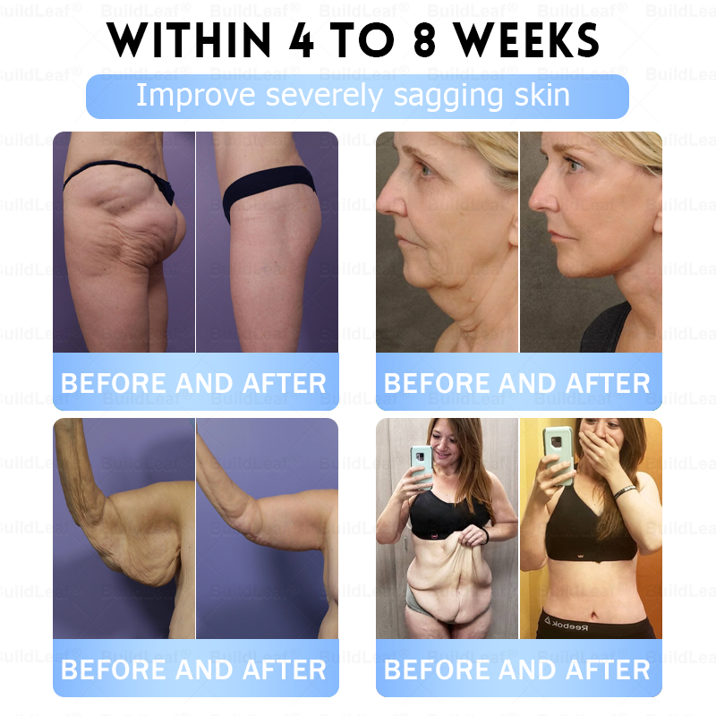 🇨🇦𝐁𝐮𝐢𝐥𝐝𝐋𝐞𝐚𝐟®Only 5 boxes left! We're offering you an additional 30% discount! Get yourself in shape and healthy. Miss out now, and you won't have another chance until next year.