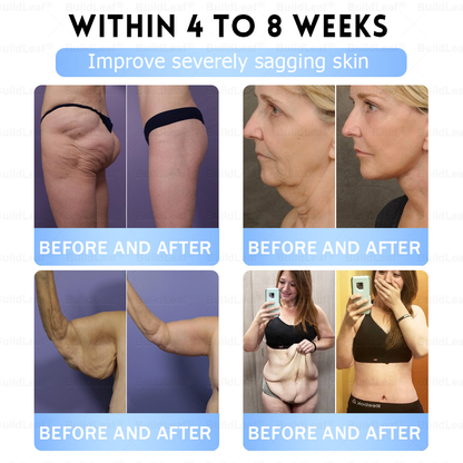 🇨🇦𝐁𝐮𝐢𝐥𝐝𝐋𝐞𝐚𝐟®Only 5 boxes left! We're offering you an additional 30% discount! Get yourself in shape and healthy. Miss out now, and you won't have another chance until next year.